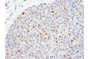 Immunohistochemistry (IHC) image for anti-Chromobox Homolog 5 (CBX5) (C-Term) antibody (ABIN7448461)