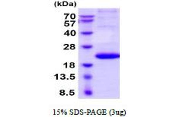 IL29 Protein (AA 20-200) (His tag)