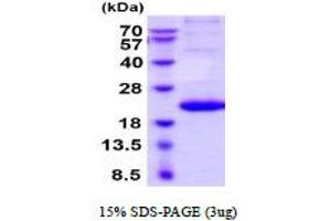 SDS-PAGE (SDS) image for Interleukin 29 (IL29) (AA 20-200) (Active) protein (His tag) (ABIN7529341)