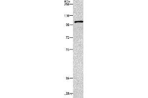 Western blot analysis of 231 cell, using TNK2 Polyclonal Antibody at dilution of 1:1800 (TNK2 Antikörper)