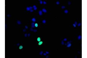 Immunofluorescence staining of MCF-7 cells with ABIN7127308 at 1:56,counter-stained with DAPI. (Rekombinanter HIST1H1E Antikörper  (pThr17))