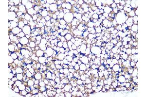 Immunohistochemistry of paraffin-embedded mouse brown adipose using Perilipin A Rabbit mAb (ABIN7269218) at dilution of 1:100 (40x lens).