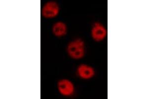 ABIN6269162 staining HeLa by IF/ICC. (CREB1 Antikörper  (Internal Region))