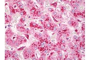 Anti-CYSLT2 / CYSLTR2 antibody IHC of human liver, Kupffer cells. (CasLTR2 Antikörper)