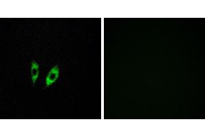 Peptide - +Western blot analysis of extracts from 293 cells, using GPR156 antibody. (GPR156 Antikörper  (Internal Region))