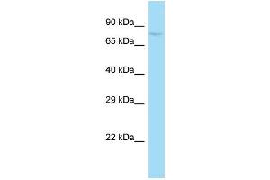 WB Suggested Anti-Sugp1 Antibody   Titration: 1. (Splicing Factor 4 Antikörper  (N-Term))