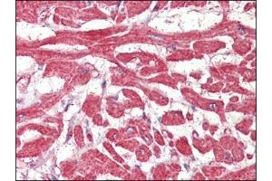 Heart, Human: Formalin-Fixed, Paraffin-Embedded (FFPE) (FABP7 Antikörper  (C-Term))