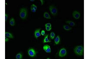 Immunofluorescent analysis of MCF-7 cells using ABIN7147059 at dilution of 1:100 and Alexa Fluor 488-congugated AffiniPure Goat Anti-Rabbit IgG(H+L)