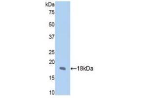 Western Blotting (WB) image for Fibrillin 1 (FBN1) ELISA Kit (ABIN6574171)