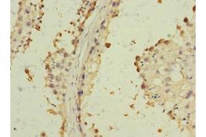 Immunohistochemistry of paraffin-embedded human testis tissue using ABIN7143441 at dilution of 1:100 (BST1 Antikörper  (AA 29-293))