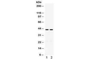 Western blot testing of human 1) A549 and 2) COLO320 cell lysate with RAD51C antibody. (RAD51C Antikörper)