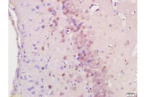 Immunohistochemistry (IHC) image for anti-Ras Association (RalGDS/AF-6) Domain Family (N-terminal) Member 8 (RASSF8) (AA 101-200) antibody (ABIN762266)