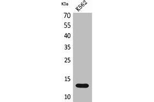Western Blot analysis of K562 cells using Lymphotactin Polyclonal Antibody. (XCL1 Antikörper  (Internal Region))