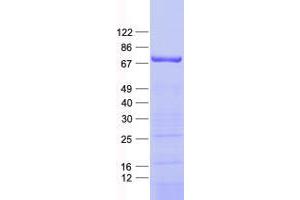 Validation with Western Blot