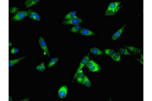 Immunofluorescent analysis of Hela cells using ABIN7169623 at dilution of 1:100 and Alexa Fluor 488-congugated AffiniPure Goat Anti-Rabbit IgG(H+L) (SPPL2A Antikörper  (AA 26-172))