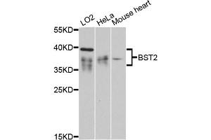 Western blot analysis of extracts of various cell lines, using BST2 antibody (ABIN6129547, ABIN6137673, ABIN6137675 and ABIN6215924) at 1:3000 dilution. (BST2 Antikörper  (AA 49-161))