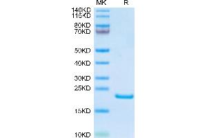 Human AGR-2 on Tris-Bis PAGE under reduced condition. (AGR2 Protein (AA 21-175) (His tag))