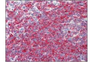 Immunohistochemistry (IHC) image for anti-Programmed Cell Death 4 (PDCD4) (AA 1-469), (N-Term) antibody (ABIN317548) (PDCD4 Antikörper  (N-Term))