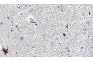 ABIN6274610 at 1/100 staining Human brain cancer tissue by IHC-P. (Cell Adhesion Molecule 4 Antikörper  (C-Term))