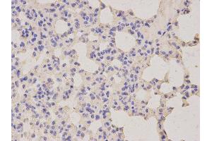 Immunohistochemistry (IHC) image for anti-Lipopolysaccharide-Induced Tumor Necrosis Factor-alpha Factor (LITAF) antibody (ABIN1876657) (LITAF Antikörper)