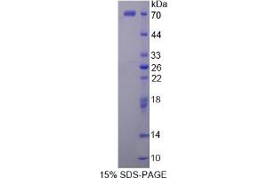 Image no. 1 for Platelet-Derived Growth Factor Receptor-Like (PDGFRL) (AA 22-375) protein (His tag,GST tag) (ABIN6236937) (PDGFRL Protein (AA 22-375) (His tag,GST tag))