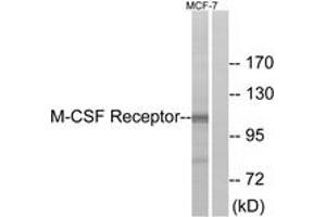 Western blot analysis of extracts from MCF7 cells, using M-CSF Receptor (Ab-723) Antibody. (CSF1R Antikörper  (AA 691-740))