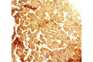 Immunohistochemistry of paraffin-embedded human heart tissue using ABIN7143697 at dilution of 1:100 (GALM Antikörper  (AA 2-342))