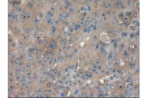 Immunohistochemical staining of paraffin-embedded kidney using anti-PTCH1 (ABIN2452537) mouse monoclonal antibody. (Patched 1 Antikörper  (AA 122-436))