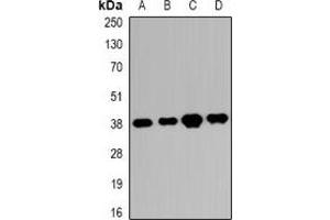 Western blot analysis of RRP7A/B expression in K562 (A), HEK293T (B), SHSY5Y (C), mouse eye (D) whole cell lysates. (RRP7A/B (C-Term) Antikörper)