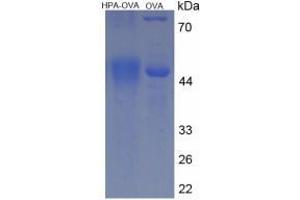 Image no. 2 for Heparanase (HPSE) protein (Ovalbumin) (ABIN1880256)