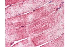 Anti-DNAJA3 / TID1 antibody IHC of human skeletal muscle.