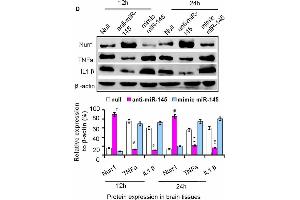 The axis signaling of miR-145-5p-Nurr1-TNF-α in acute MCAO/R model of rats by in vivo expriments. (beta Actin Antikörper)