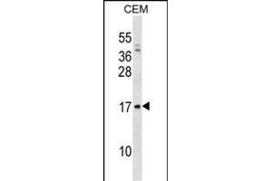 VPREB1 Antibody (Center) (ABIN1538592 and ABIN2838302) western blot analysis in CEM cell line lysates (35 μg/lane). (VPREB1 Antikörper  (AA 71-99))