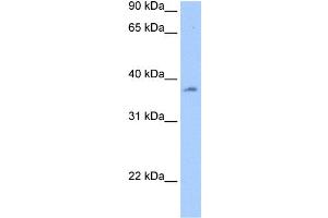 WB Suggested Anti-RBMY1A1 Antibody Titration:  0. (RBMY1A1 Antikörper  (N-Term))
