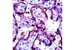 Immunohistochemical staining of human placenta stained with MMP9 polyclonal antibody  at 1 : 100 for 10 min at RT. (MMP 9 Antikörper)