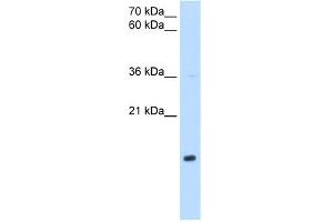 WB Suggested Anti-NDUFB5 Antibody Titration:  0. (NDUFB5 Antikörper  (Middle Region))