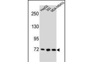 ZN Antibody (C-term) (ABIN655698 and ABIN2845151) western blot analysis in HepG2,293,MDA-M cell line lysates (35 μg/lane). (ZNF860 Antikörper  (C-Term))