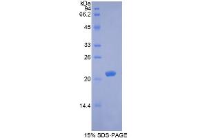 SDS-PAGE analysis of Rabbit BDNF Protein.