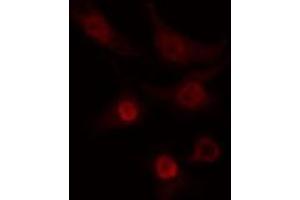 ABIN6274267 staining COLO205 cells by IF/ICC. (CLK2 Antikörper  (N-Term))