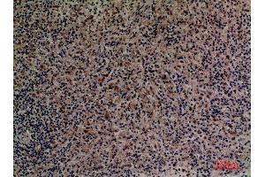 Immunohistochemistry (IHC) image for anti-Protein C Receptor, Endothelial (PROCR) (Internal Region) antibody (ABIN3187808)