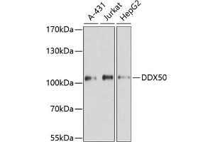Western blot analysis of extracts of various cell lines, using DDX50 antibody (ABIN6129371, ABIN6139509, ABIN6139510 and ABIN6224730) at 1:3000 dilution. (DDX50 Antikörper  (AA 1-135))