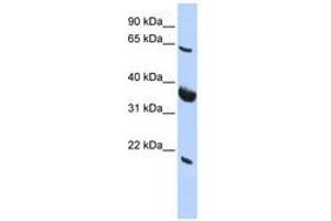 Image no. 1 for anti-Signal Recognition Particle Receptor (Docking Protein) (SRPR) (AA 215-264) antibody (ABIN6740671) (SRPR Antikörper  (AA 215-264))