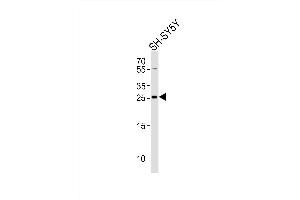 Western blot analysis of lysate from SH-SY5Y cell line, using ZDHHC21 Antibody (N-term)( (ABIN651365 and ABIN2840203)).