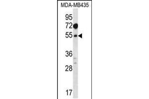 Western blot analysis in MDA-MB435 cell line lysates (35ug/lane). (MAT1A Antikörper  (N-Term))
