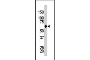 The PCTK3 polyclonal antibody  is used in Western blot to detect PCTK3 in HL-60 cell lysate.
