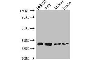 Western Blot Positive WB detected in:HEK293 whole cell lysate,PC-3 whole cell lysate,Mouse kidney tissue,Mouse brain tissue All lanes:CBR1 antibody at 2. (CBR1 Antikörper  (AA 176-268))