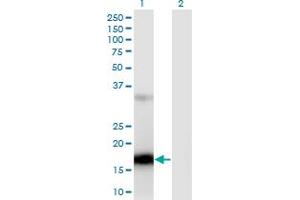 Western Blot analysis of ZCCHC13 expression in transfected 293T cell line by ZCCHC13 monoclonal antibody (M02), clone 4G11. (ZCCHC13 Antikörper  (AA 1-166))
