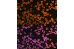Immunofluorescence analysis of THP-1 cells using TNFRSF10A Polyclonal Antibody (ABIN6127583, ABIN6149301, ABIN6149303 and ABIN6216204) at dilution of 1:100 (40x lens). (TNFRSF10A Antikörper  (AA 269-468))
