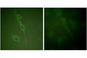 Immunofluorescence analysis of HuvEc cells, using IL-7R/CD127 (Phospho-Tyr449) Antibody. (IL7R Antikörper  (pTyr449))