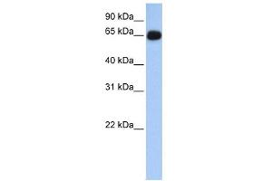 ALAS1 antibody used at 1 ug/ml to detect target protein. (ALAS1 Antikörper  (N-Term))